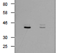 GST-tag in the group Alla produktegenskaper at Agrisera AB (Antibodies for research) (AS20 4513)